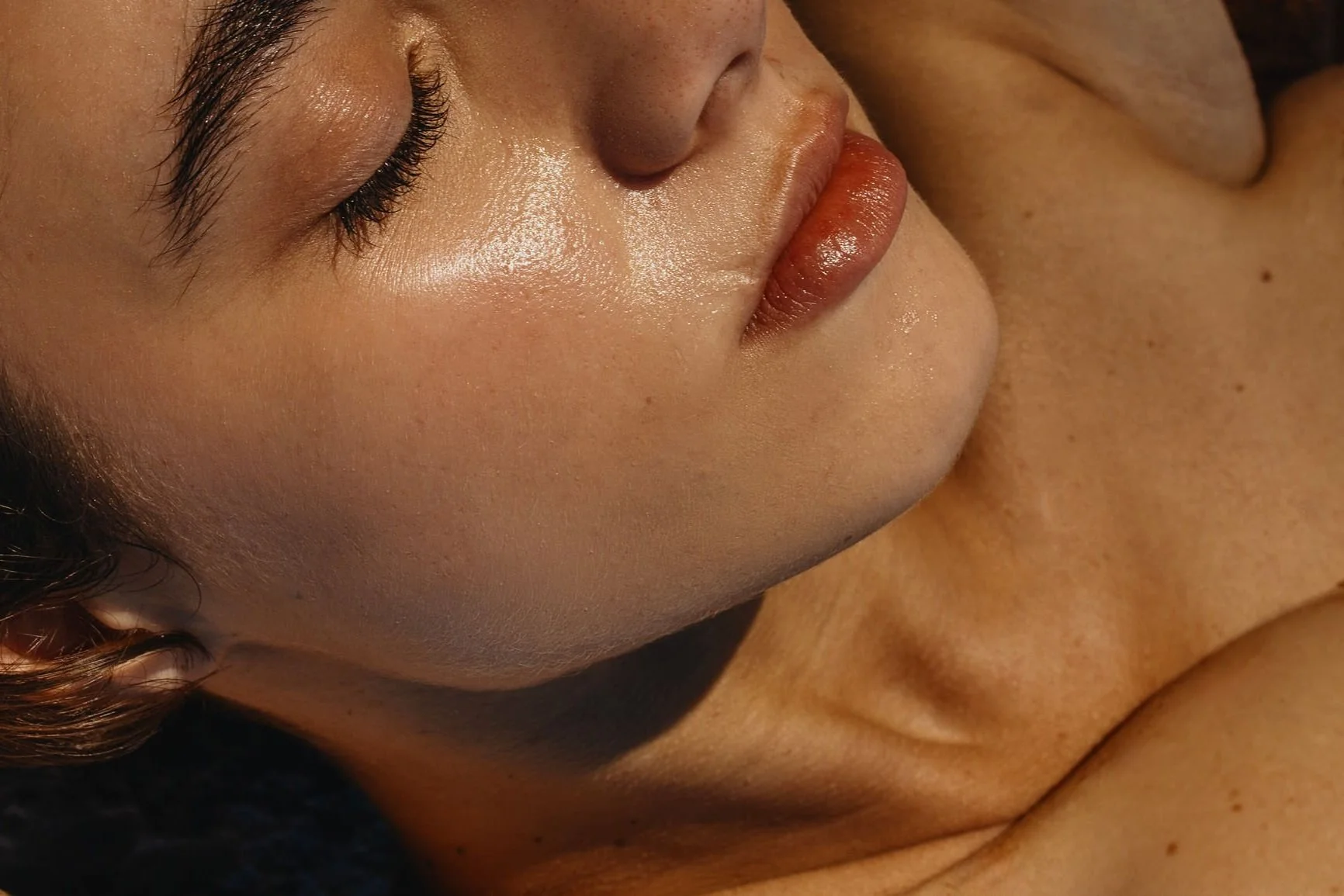 Opus® RF Plasma Skin Resurfacing Reno, NV